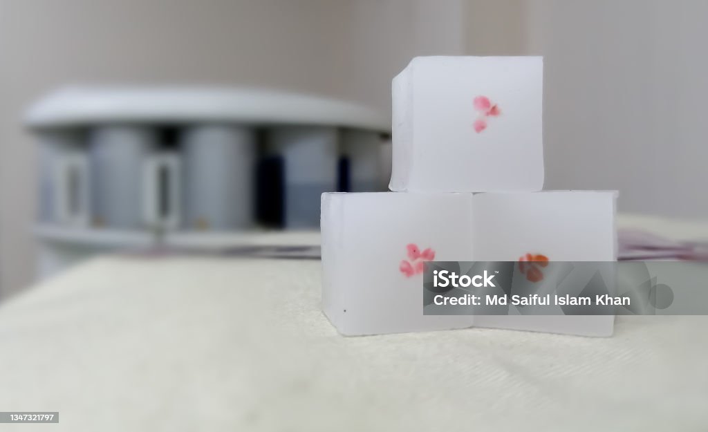 Paraffin embedded tissue blocks of cancer on isolated with laboratory Background.Medical patholology and cytology laboratory technology concept Microscope Slide Stock Photo