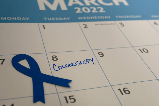 Colonoscopy Marked on the Calendar Colonoscopy appointment marked on the calendar during March, which is Colon Cancer Awareness month represented by the blue ribbon colorectal cancer photos stock pictures, royalty-free photos & images