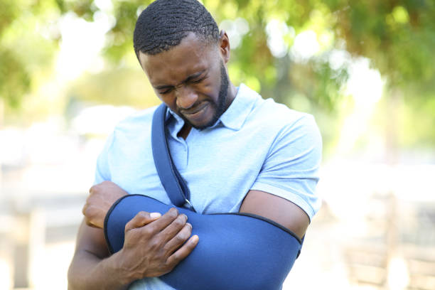 homme à la peau noire avec un bras blessé se plaignant - arm sling photos et images de collection