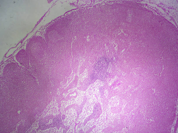Lymph node section Histology microscope image of lymph node section showing capsule and medullary sinus (40x) lymph node photos stock pictures, royalty-free photos & images