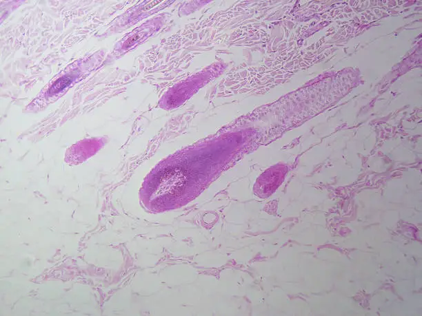 Histology image of hair bulb in the dermis of skin (100x)