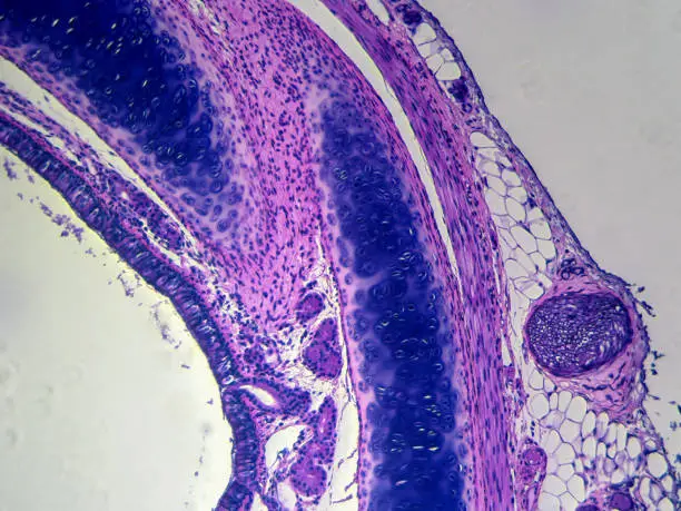 Histology image of trachea showing hyaline cartilage and ciliated pseudostratified epithelial tissue