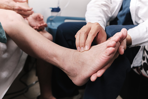 médico que toma el pulso del paciente en el pie photo