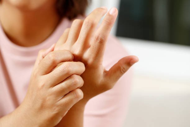 istock Health problems, woman has itchy hands 1347684475