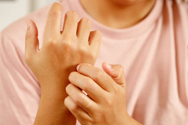 istock Health problems, woman has itchy hands 1347684497