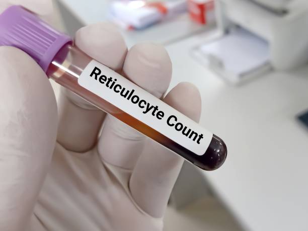 blood sample for reticulocyte count test. immature red blood cell (rbc) analysis in hematology. medical test tube in laboratory background. - blood red blood cell blood cell blood sample imagens e fotografias de stock