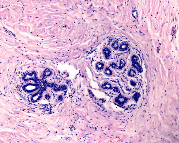 ghiandola mammaria umana. unità lobule tubulari (tdlu) - lactiferous duct foto e immagini stock