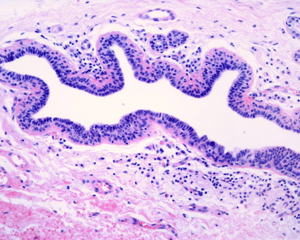 istock Human breast. Lactiferous duct 1347744489