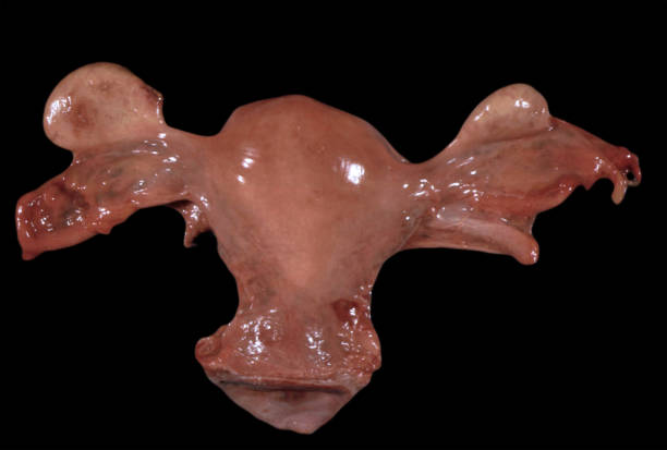 istock Human uterus, fallopian tubes and ovaries 1347840104