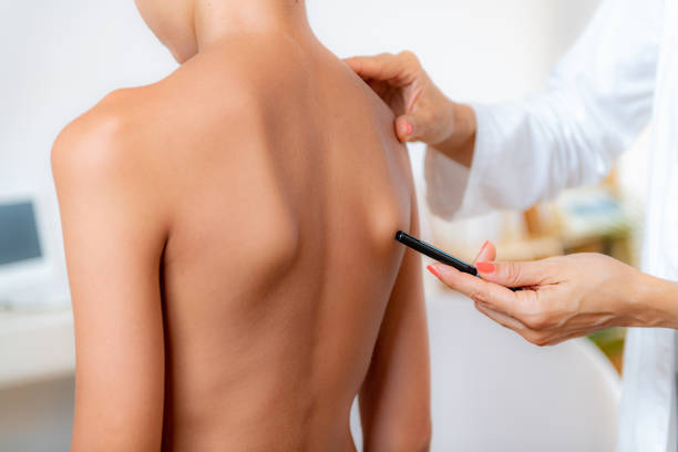 istock Pediatric doctor examining posture of a boy, making marks on his back, checking angle of scapula bones. 1347858213
