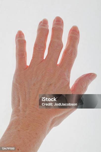 Hand With Arthritis Stock Photo - Download Image Now - Scleroderma - Illness, Rheumatoid Arthritis, Arthritis