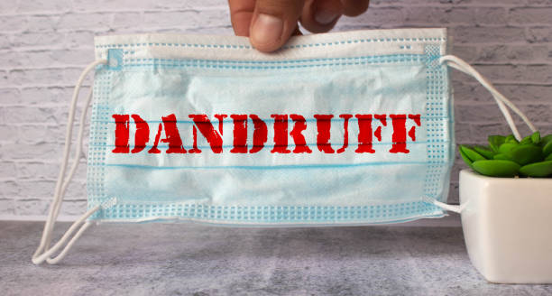 istock the word dandruff on a medical mask 1347970135