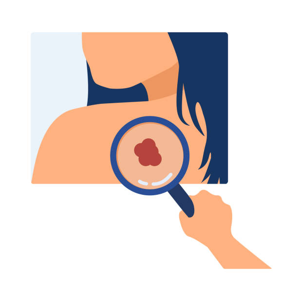 diagnoza raka skóry - unwell one person suntan lotion danger stock illustrations