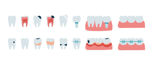 Set of teeth with dental diseases. Oral problems, caries, tartar, plaque, implant, orthodontic braces, various injuries. Collection of dentistry icons in flat style. Isolated on white vector illustration.