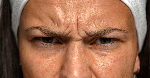 woman with wrinkles between the eyebrows close up of a frowning woman with wrinkles between the eyebrows wrinkled forehead stock pictures, royalty-free photos & images