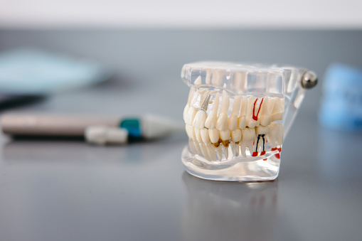 Prosthetic human jaw on table at clinic