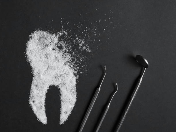 Sugar harms the tooth enamel. Sugar harms the tooth enamel. Image of a destroyed sugar tooth with medical instruments on a black background. Concept of dental medicine. tooth enamel stock pictures, royalty-free photos & images