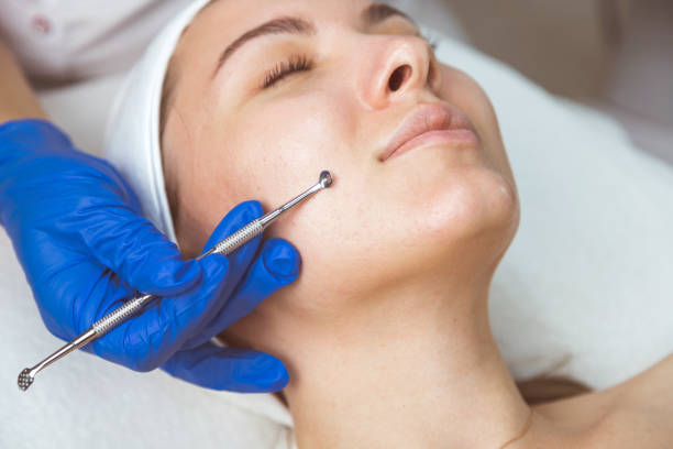 istock Beautician using professional multiple hole spoon to clean cleansing face and pores. 1348298419