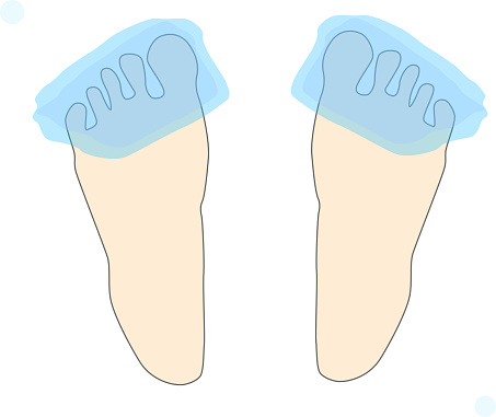 Cold Intolerance Foot Cold Sensitivity That Makes Your Feet Cold Stock Illustration ...