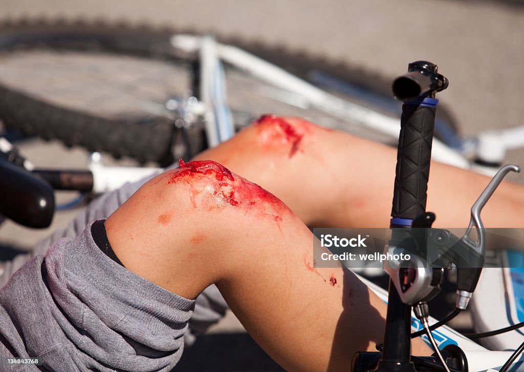 Bike fall injuries Bicycle fall. Accident injuries simulation. Bicycle Stock Photo