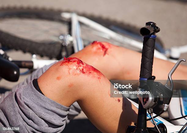 Bike Fall Injuries Stock Photo - Download Image Now - Bicycle, Blood, Crash