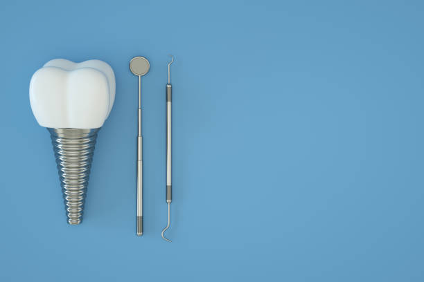 istock Tooth Implant, Artificial Teeth, Dental Implantation, Blue Background 1348844870