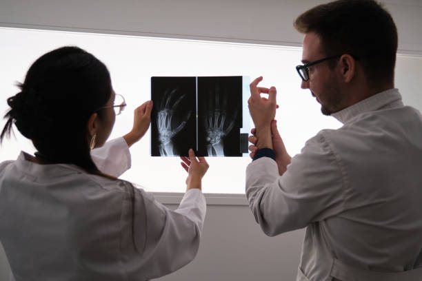 professionelles medizinisches team, das handröntgenbilder untersucht. rheumatoide arthritis. - x ray x ray image human hand anatomy stock-fotos und bilder