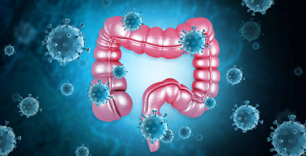 рак толстой кишки, вирусы, бактерии в больном нездоровом кишечнике. понятие заболевания толстой кишки. 3d иллюстрация - 2237 стоковые фото и изображения