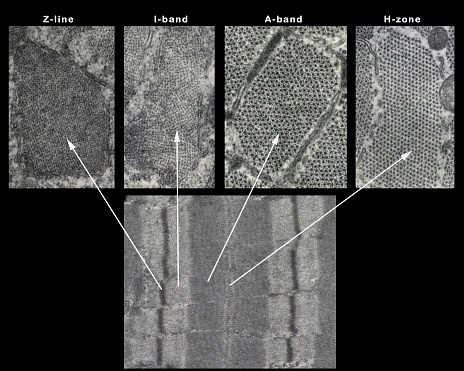 Transmission electron microscope micrographs  showing the aspect of muscle fiber sarcomere components in longitudinal (below) and transverse (above) sections at the Z-line, I and A bands and H zone