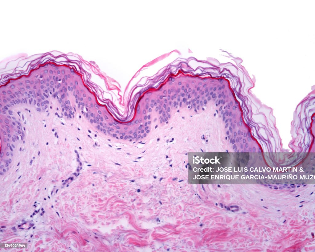 Epidermis. Thin skin Thin skin showing the epidermis with their different layers resting on dermis. Skin Stock Photo