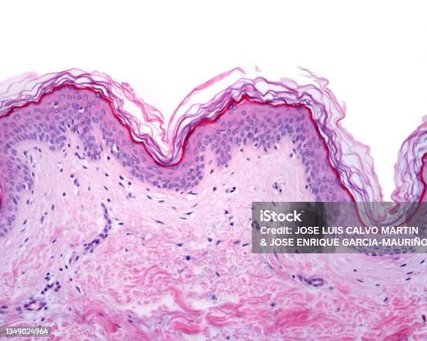 Epidermis Thin Skin Stock Photo - Download Image Now - Skin, Dermis, Histology