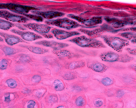 Epidermis of thin skin. Detail of keratinocytes of the stratum spinosum and granulosum (showing numerous granules of keratohyalin).