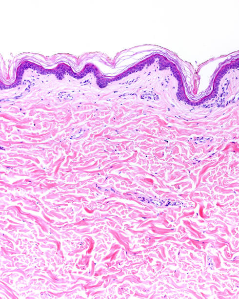 istock Human thin skin. Epidermis and dermis 1349025047