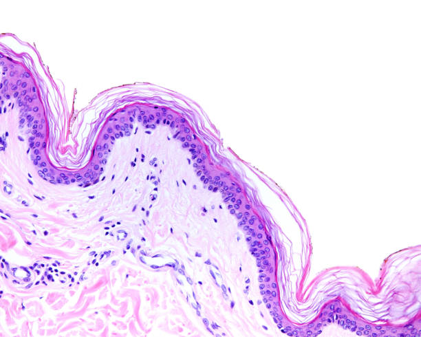 istock Human thin skin. Epidermis and dermis 1349025059