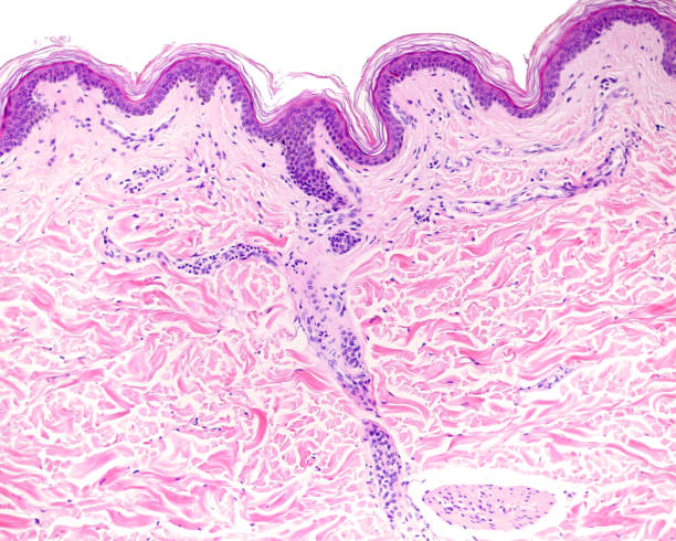 istock Human thin skin. Epidermis and dermis 1349025071