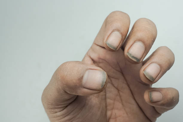 istock Close-up of hands with dirty nails 1349214314