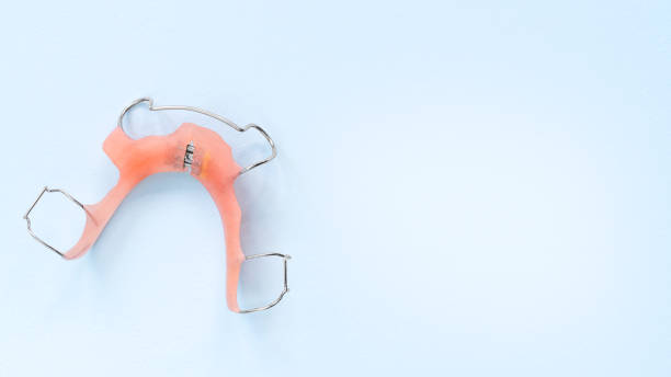 istock removable orthodontic appliance on Blue background 1349214537