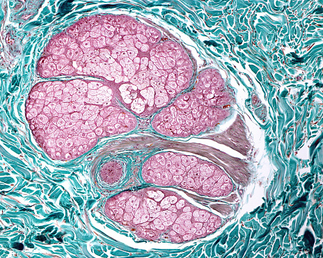 Cross section showing all the components of pilosebaceous unit: in the center, the hair, surrounded by sebaceous glands and smooth muscle fibers of arrector pili muscle. Masson stain.