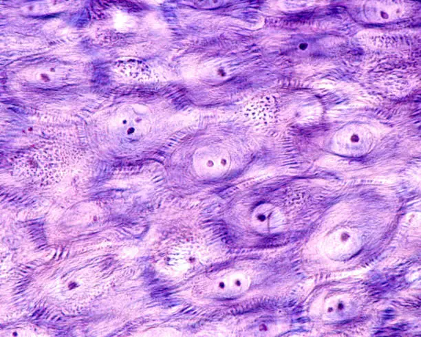 Photo of Epidermis. Stratum spinosum. Desmosomes