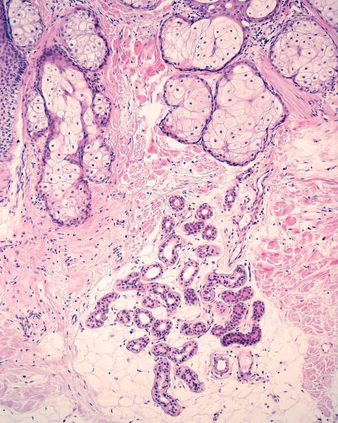 istock Human hairy skin. Sebaceous  and sweat glands 1349277978