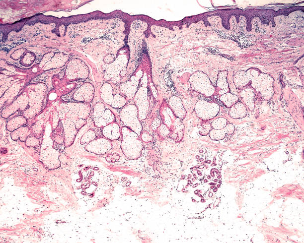 Human hairy skin. Sebaceous glands Low magnification micrograph showing the different location of the sebaceous glands (more superficial, in reticular dermis) and sweat glands (more deep, in the adipose tissue of hypodermis). arrector pili stock pictures, royalty-free photos & images