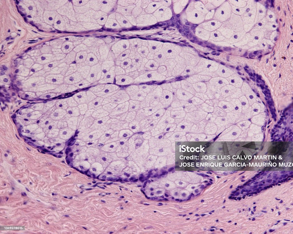 Human Skin Sebaceous Glands Stock Photo Download Image Now Sebaceous ... Biology Diagrams