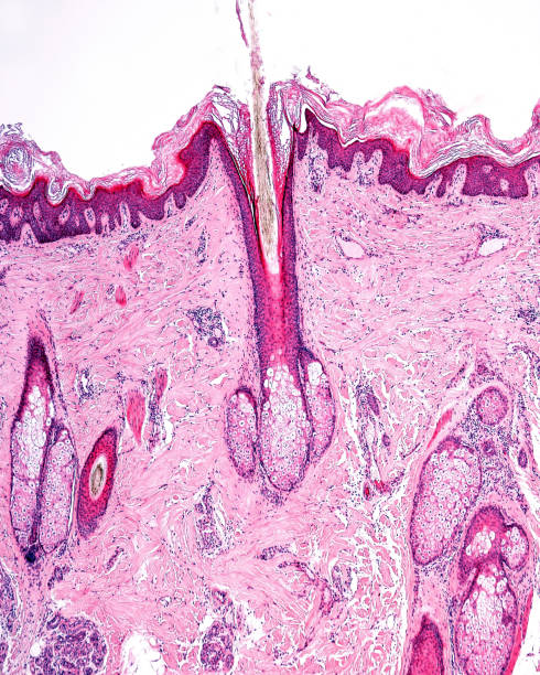 menschliche haut. haarbalg. pilosebaceous einheit - histology stock-fotos und bilder