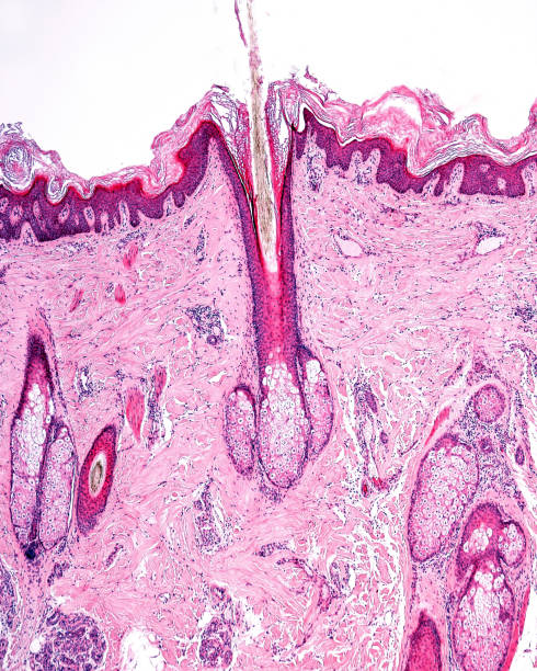 ludzka skóra. mieszków włosowych. jednostka pilosebaceous - histology zdjęcia i obrazy z banku zdjęć