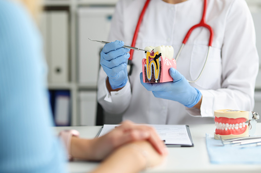 Dentista muestra en modelo dental cómo la caries destruye el esmalte dental photo