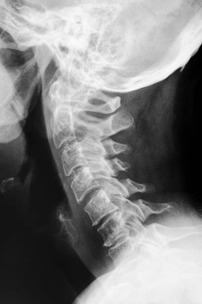Cтоковое фото X-ray of a human вырезом и черепом