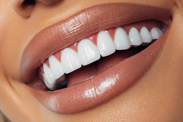 sorriso perfetto della donna - human mouth human teeth indoors young women foto e immagini stock