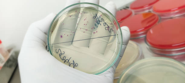 istock E. Coli colonies, GNR, Gram negative Rods colonies as test on Chomogenic UTI Agar plate, laboratory background 1349408844