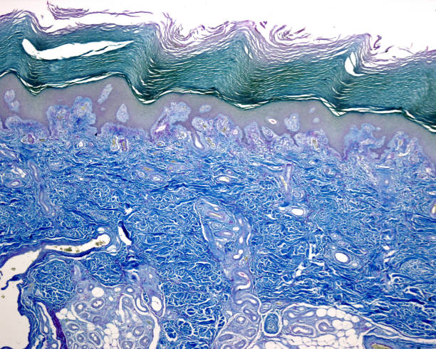 Human skin. Epidermis and dermis