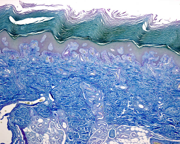 Human skin. Epidermis and dermis Low magnification micrograph of a human thick skin stained with the Cajal-Gallego’s method. The epidermis (with a thick stratum corneum) and the dense irregular connective tissue of the dermis are clearly seen human tissue stock pictures, royalty-free photos & images